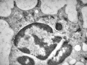 M,2w. | bacteriaemia - phagocytosed microbes M,2w. | bacteriaemia - phagocytosed microbes